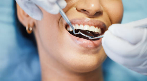 Best Emergency Dental Extractions in Concordia, MO